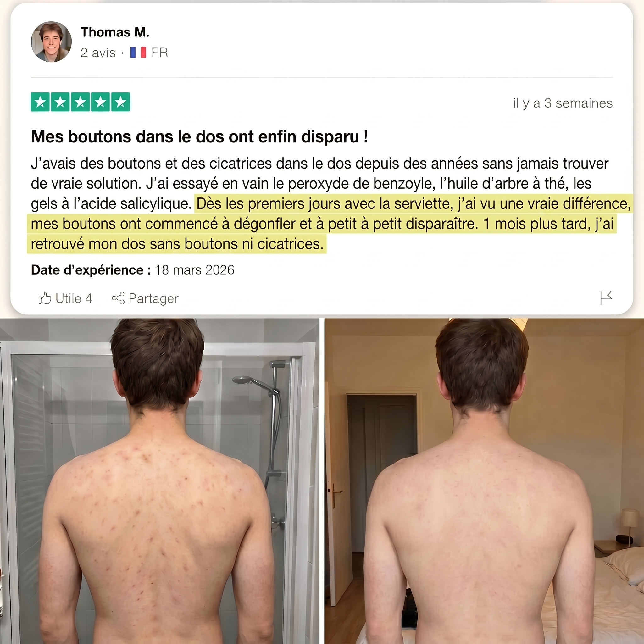 Serviette Exfoliante Japonaise - Anti Imperfection du Dos
