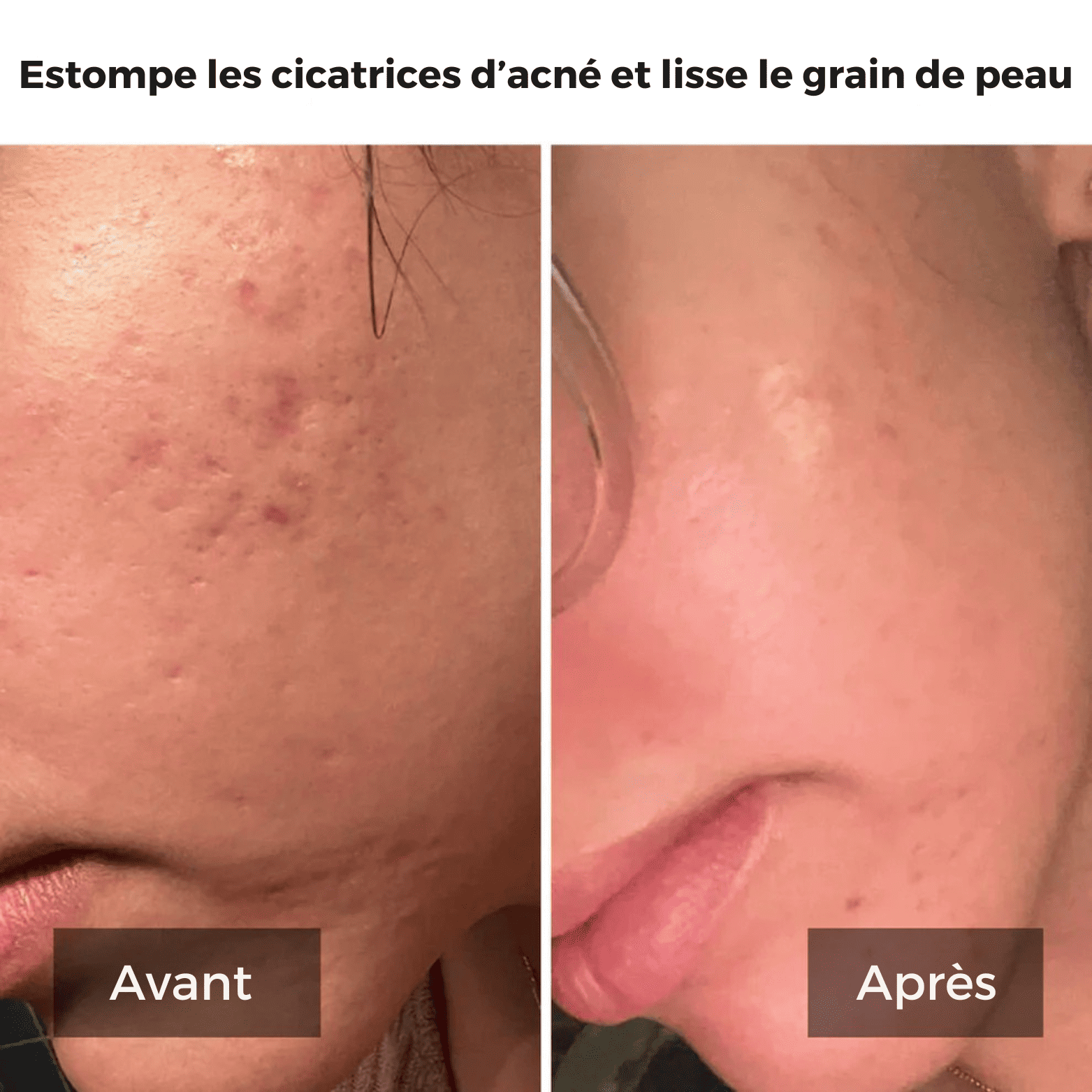Masque de Nuit au Curcuma et à l'Acide Kojique