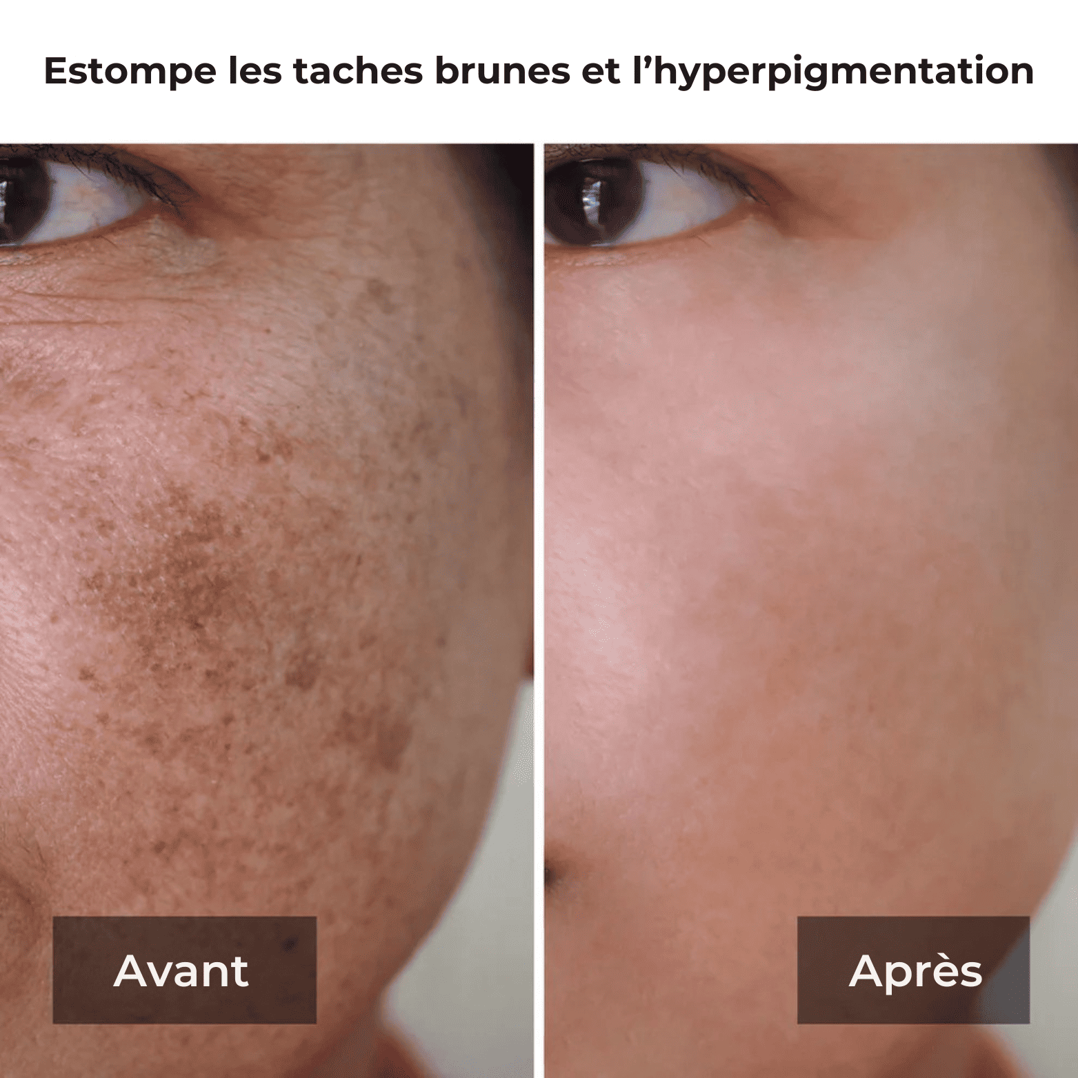 Masque de Nuit au Curcuma et à l'Acide Kojique