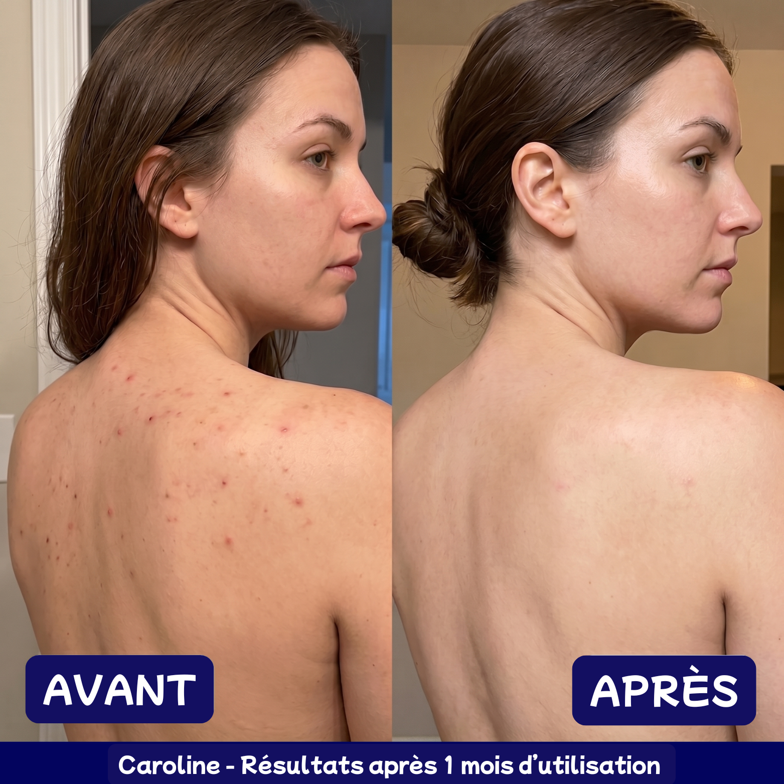 Serviette Exfoliante Japonaise - Anti Imperfection du Dos